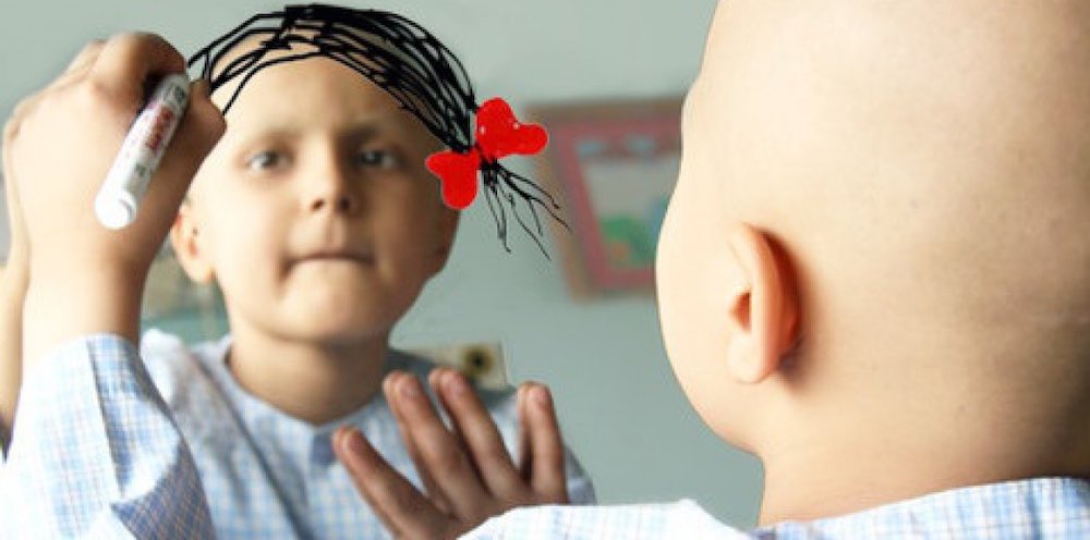 Bimba di 8 anni perso capelli chemioterapia