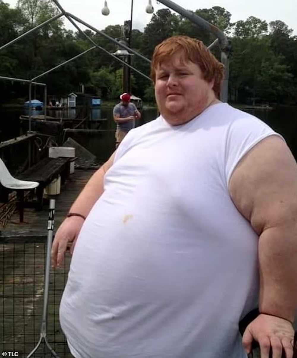 Un uomo 320 kg rifiuta di perdere peso